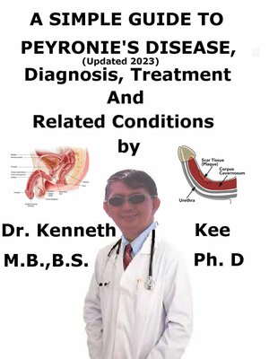 cover image of A Simple Guide to Peyronie's Disease, (Updated 2023) Diagnosis, Treatment and Related Conditions